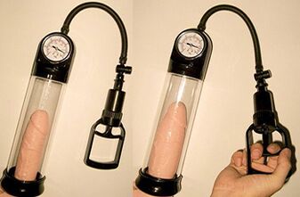 Penis enlargement by 3-4 cm in 1 day using a vacuum pump