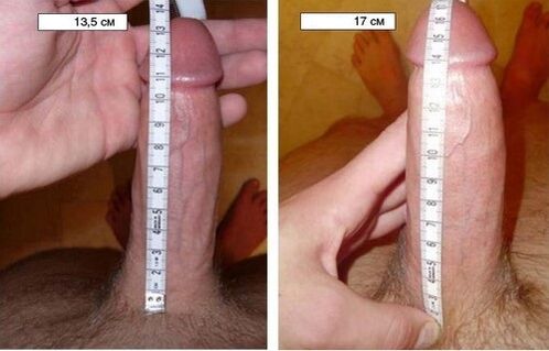 Penis before and after enlargement with pump