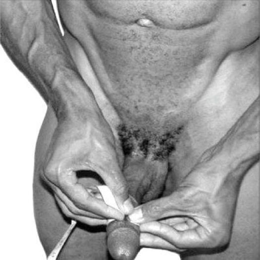 Penis measurement before enlargement